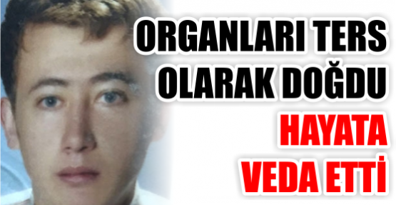 ... lokantada bulaşıkçılık yapan Dursun Gündoğan ile ev hanımı Güliser Gündoğan&#39;ın oğlu 33 yaşındaki Durmuş Gündoğan ikametinde kalp krizi geçirdi. - organlari_ters_olarak_dogdu_yasam_mucadelesini_kaybetti_h24562